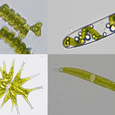 Einzellige Zieralgen im Lichtmikroskop
